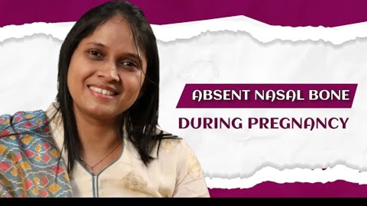 Absent Nasal Bone During Pregnancy